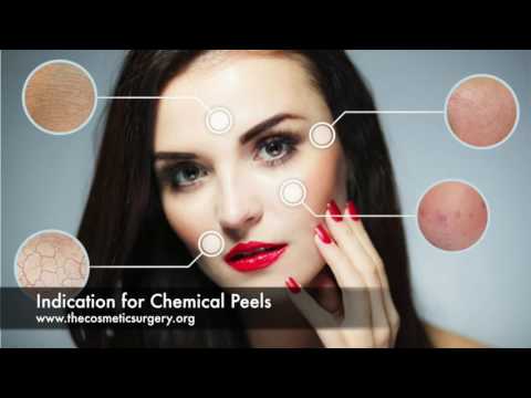 chemical-peel---cost,-risks,-recovery-&-types-of-facial-peels-at-chennai-plastic-surgery