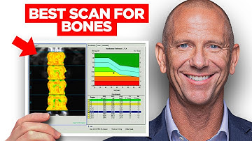 DEXA Scan vs REMS Scan:  Which Test Shows Your Real Fracture Risk? [Doctor Explains]