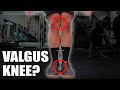 Valgus Knee