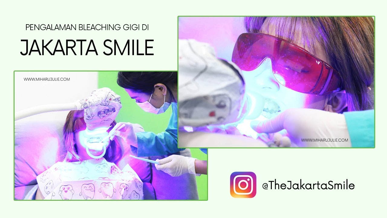 Pengalaman Bleaching Gigi di Jakarta Smile YouTube