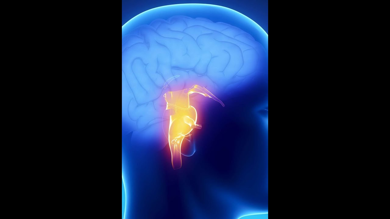 Brainstem syndromes (stroke localization part 3) - YouTube