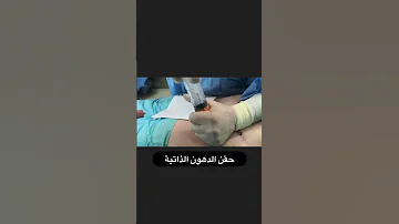 حقن الدهون الذاتيه 
