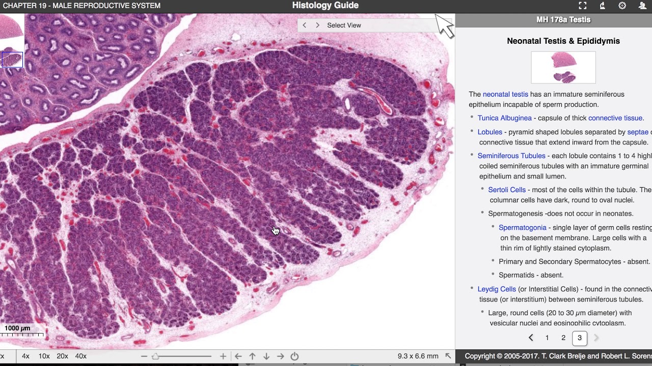 HISTOLOGI (MANNLIGE GENITALIA): TESTIS VOKSEN VS BARN ...