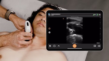Ultrasound for Subclavian Central Line Placement