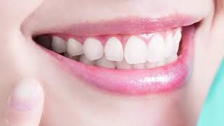 Dentist in Lithia | Smile Design Lithia Dentist