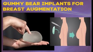 Gummy bear implants for breast augmentation.
