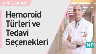 Hemeroid Türleri ve Tedavi Seçenekleri Nelerdir?