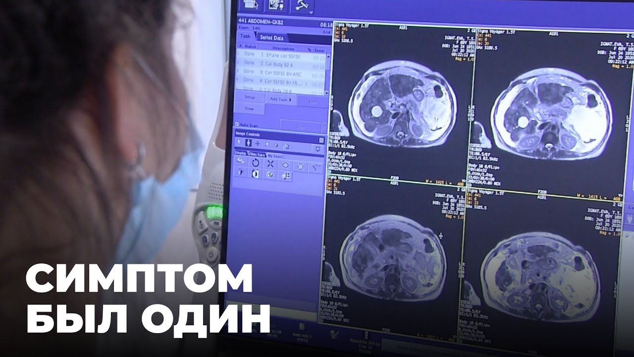 Стали чаще умирать от рака лёгких?