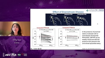 Beginning with the end in mind - FFR vs. IVUS imaging - AICT-AsiaPCR 2022
