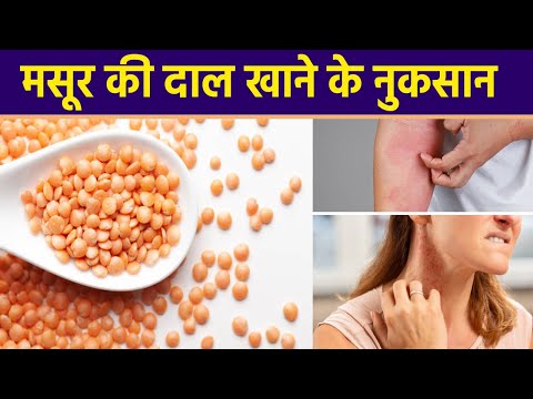 वीडियो: आलू पर मसूर क्या हैं: आलू में मसूर की दाल बढ़ने के कारण