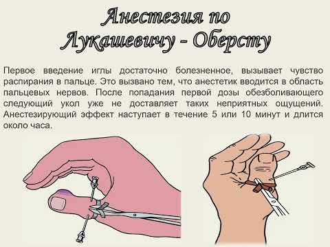 Гнойные заболевания пальцев и  кисти