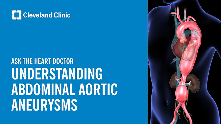 Ask the Heart Doctor | Understanding Abdominal Aortic Aneurysms