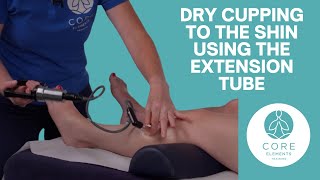 Clinical Dry Cupping using the extension tube - shin region