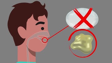 Induced Sputum Collection -  English Version