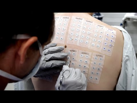 वीडियो: Atopy - एक एलर्जी त्वचा प्रतिक्रिया