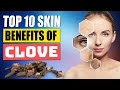 Top 10 Clove Skin Benefits And Homemade Beauty Recipes Top 10 Clove Skin Benefits And Homemade Beauty Recipes