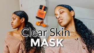 DIY MAKUNA HONEY & TURMERIC SKIN BRIGHTENING MASK FOR CLEAR SKIN (ACNE and Dark Spots)| SKINCARE