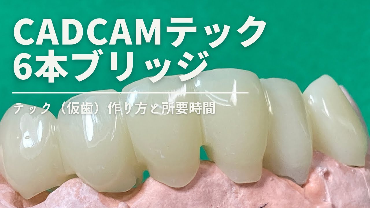 歯科技工士】テンポラリークラウン（テック）の、歯科用CAD／CAM