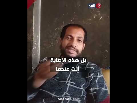 أطفالنا لا يجدون ما يأكلونه مواطن فلسطيني يتحدث عن أوضاع معيشية داخل مراكز الإيواء في شمال غزة