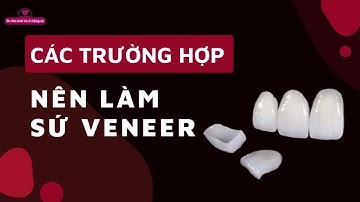 Các trường hợp nên làm sứ veneer | Tt niềng răng quốc tế Diamond
