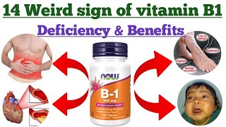 14 weird sign of vitamin B1 deficiency and Benefits.