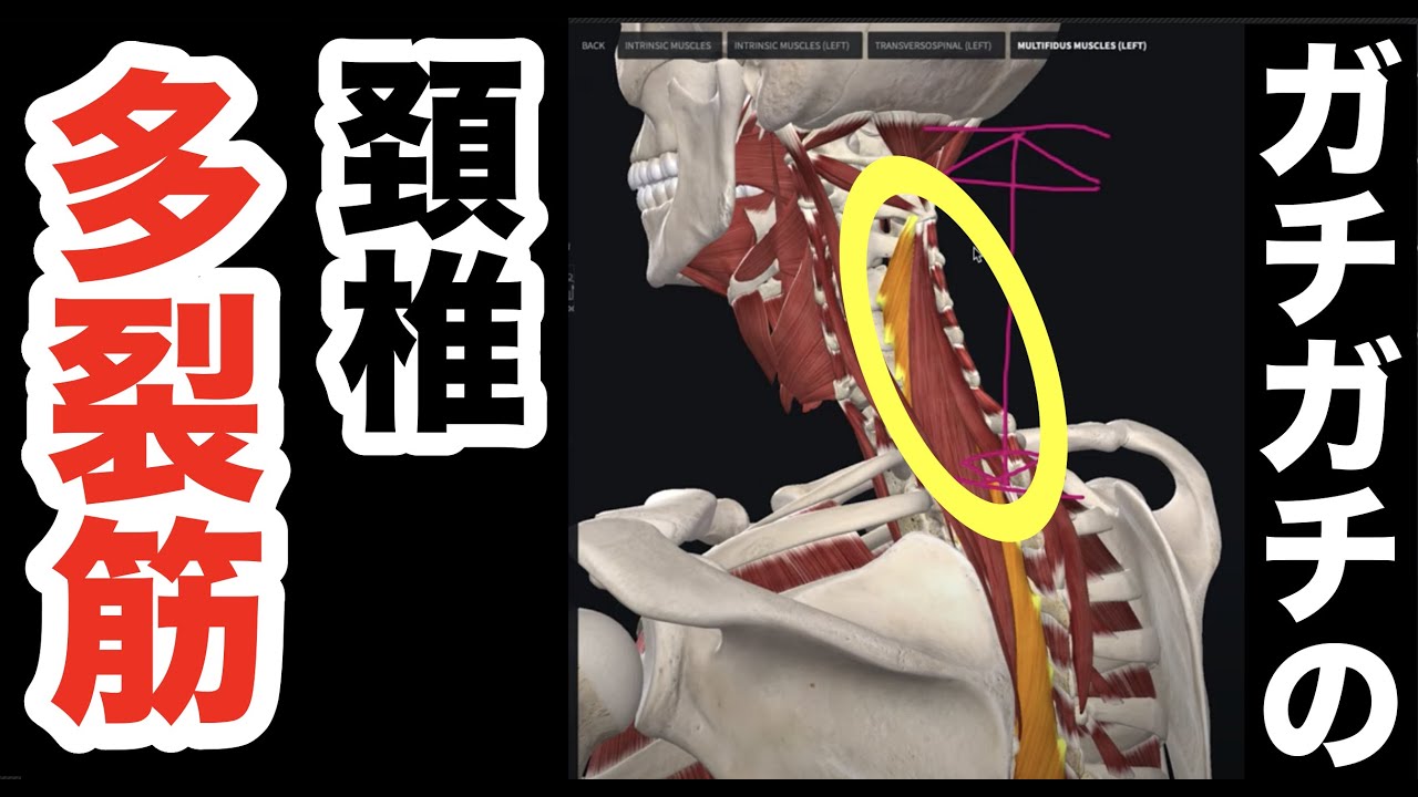 ガチガチの””頚椎多裂筋””を徹底的にユルユルにして、ストレートネックの再発をなくす方法！【腰痛 治し方 ストレッチ】How to loosen the cervical spine