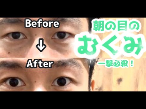 恵比寿 レンズ 美容 院