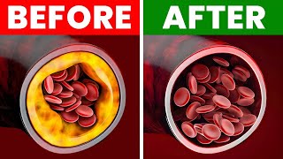 What to Eat to Clean Out Your Arteries—Dr. Berg Explains screenshot 5