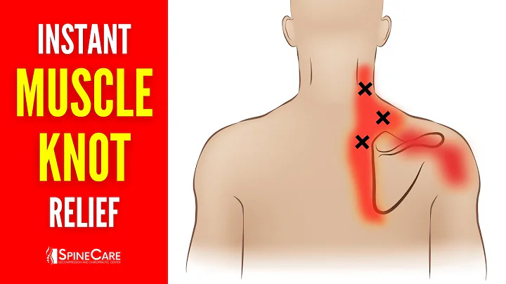 How to Quickly Fix Muscle Knots in Your Neck, Shoulders, and Back