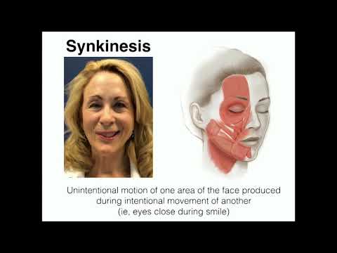 What is Facial Synkinesis