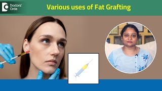 Various uses of FAT GRAFTING|Dr.Shetty's Cosmetic Centre,Bangalore|Dr.Ramya Deepthi|Know Your Doctor