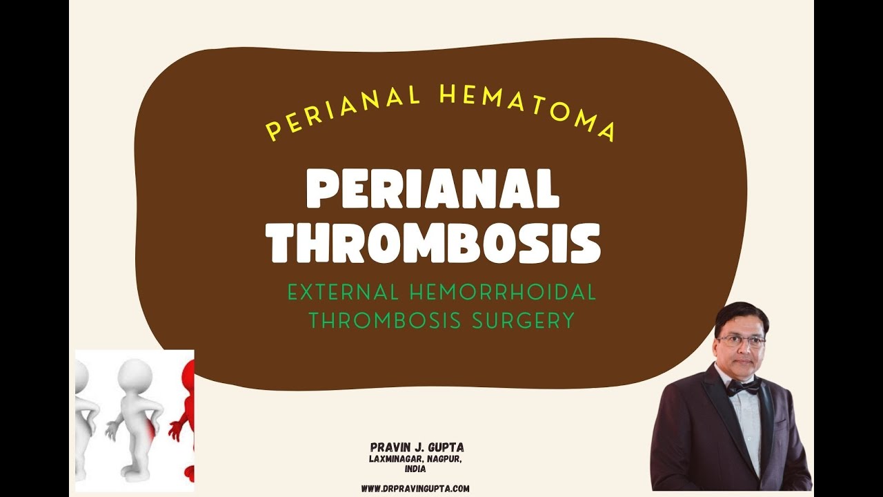 SURGERY OF A PERIANAL THROMBOSIS (PERIANAL HEMATOMA) YouTube