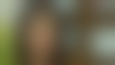 Nâng ngực nội soi là gì - Đặt túi ngực những điều cần lưu ý