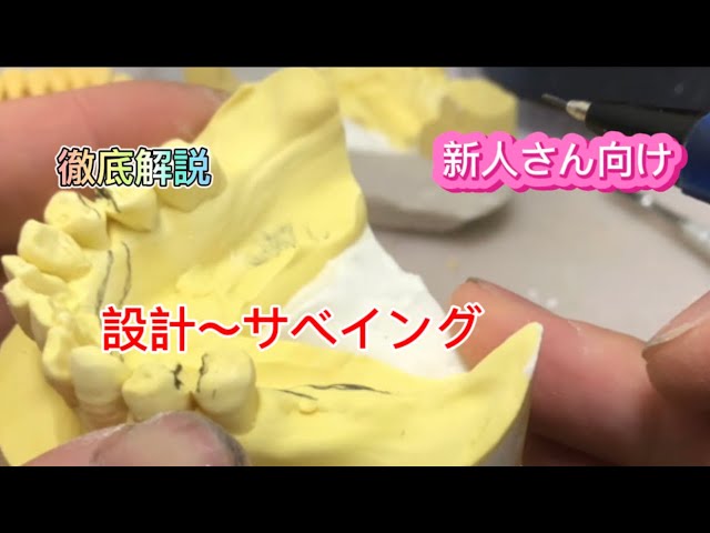 Design ~ Surveillance Dental Technician - YouTube