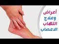 اقوى علاج لمرضى الاعصاب بالاعشاب الطب البديل الصحة