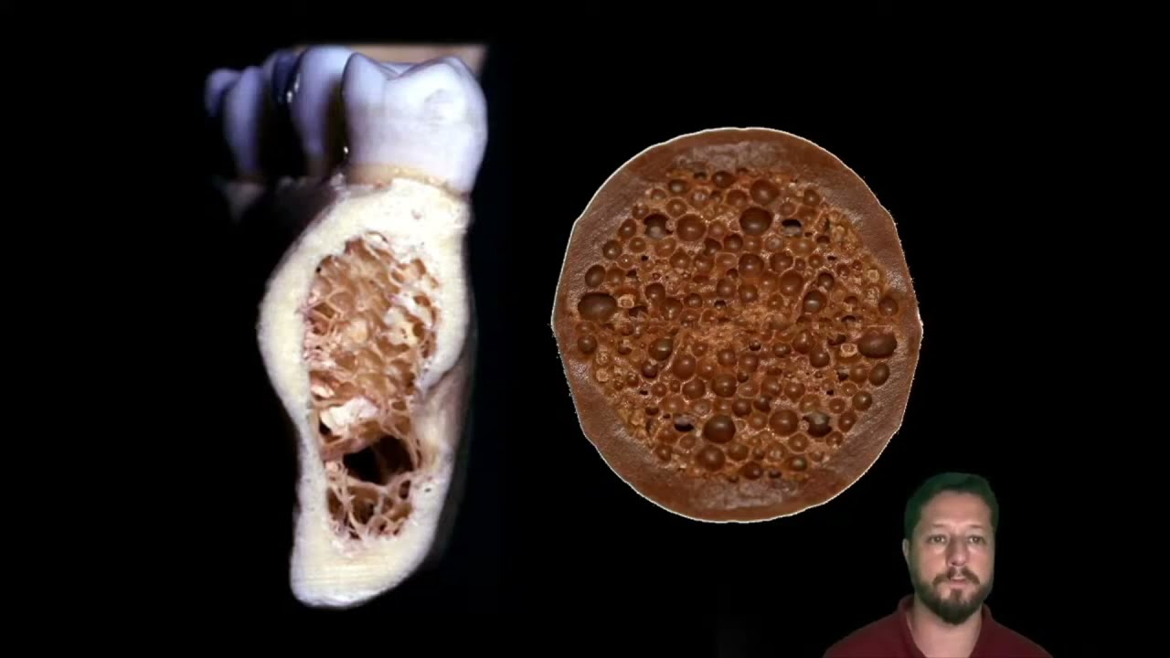 Doenças periapicais: breve introdução e pericementite