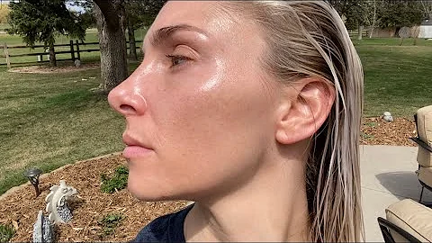 RETIN A 15 MONTH BEFORE & AFTER // TRETINOIN