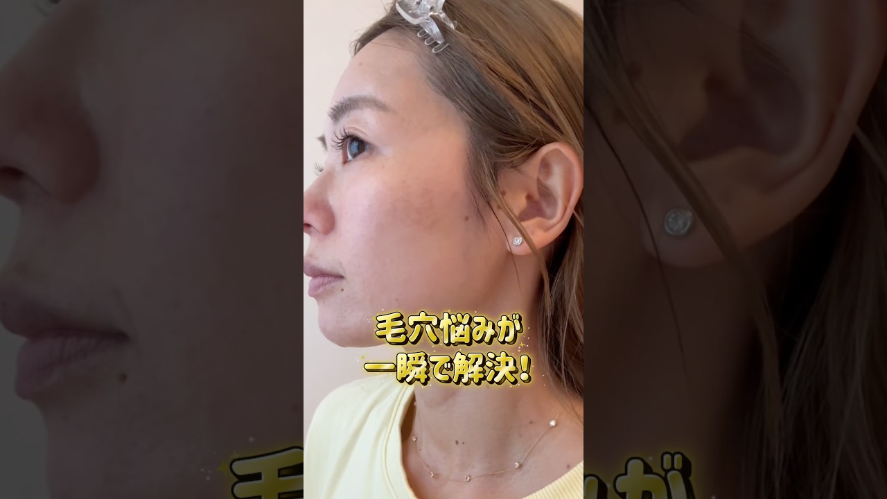 【鈴木あや】で検索してTiktokやInstagram遊びにきてね😗✨ #毛穴 #毛穴ケア