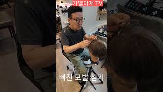 가발 빠진모발 심기