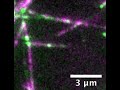 Nerve Cell Highway Repair Crews in Action