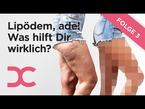 Bauchstraffung Schlaffe Haut Am Bauch Straffen Dr Holdenried Dorow Clinic Bei Zurich Youtube