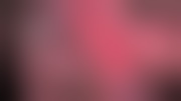 Asvide: Right middle lobe lateral segmentectomy S5