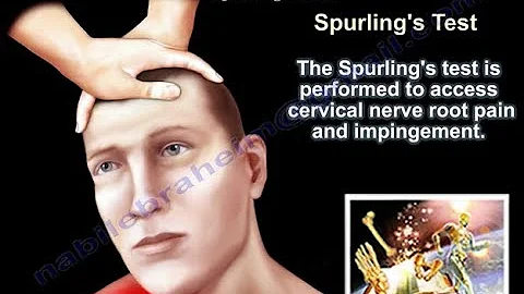 Cervical Spine Radiculopathy , Spurling's Test - Everything You Need To Know - Dr. Nabil Ebraheim