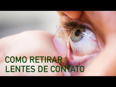 #6 Dicas Para Retirar Lentes Gelatinosas | Dr. Gilson Mariano | Oftalmologista