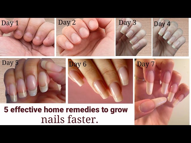 Only 11 Days ~ Grow Your Nails Faster with this home remedy नाखून बढ़ाने का  देसी नुस्ख़ा - YouTube