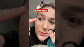 Doctor Explains Lazy Eyes
