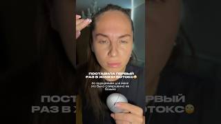 Поделитесь своим опытом 😍 #ботокс #липолитики