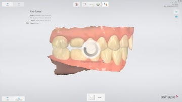 3Shape TRIOS   How to send scan to the lab and patient