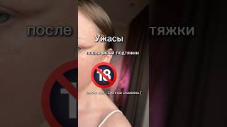 Подтяжка лица реабилитация,средний чик лифтинг ,расшинная платизмопластика