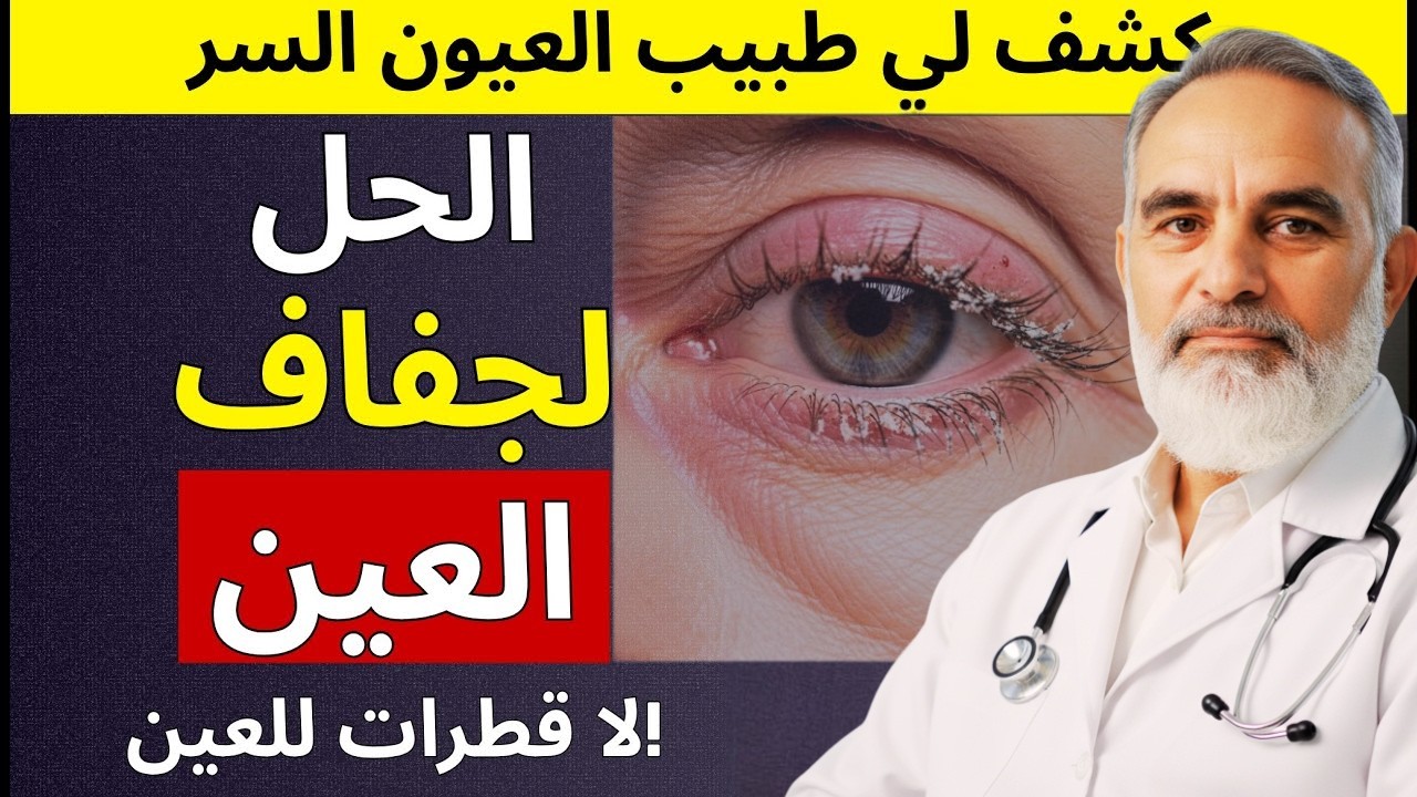 تخلص من جفاف العين نهائيًا! 7 طرق طبيعية فعّالة بدون الحاجة للقطرات